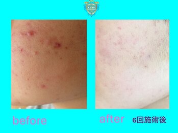 リュクス(LUXE)/ビフォーアフター