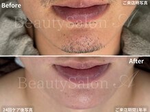 エース(A)の雰囲気(肌にやさしく!結果にこだわる脱毛。)