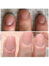 ココネイル(coco.nail)