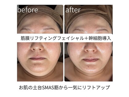 ビガク(BIGAKU)の写真