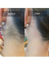 トゥルーリー(TRULY)/《うなじワックス》