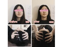 アロマリラクゼーションケイズ(Aroma Relaxation K's)の雰囲気(小顔矯正+頭蓋骨調整)