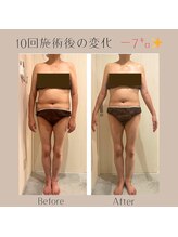 ナナイロ(nanairo)/7キロの減量に成功！