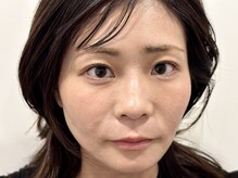 トミー(Tommy)/まつ毛パーマ