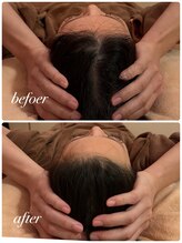 シャルマン(Charmant)/お顔＆ヘッド筋膜リリース