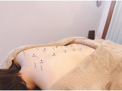 高田馬場はりきゅう院【首肩こり/腰痛/眼精疲労/ヘッドスパ/生理/自律神経/美容鍼】の写真