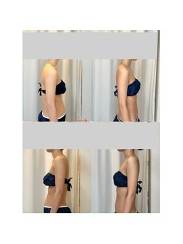 ティアエ(T-ae)/【ブライダルエステ】