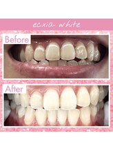 エクシアホワイト SOKA(ecxia white)/