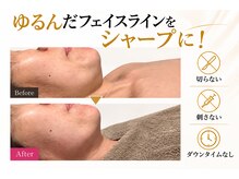 エン 橿原店(en)の雰囲気（見えにくいところに年齢が出るからフェイシャルエステが必要！）