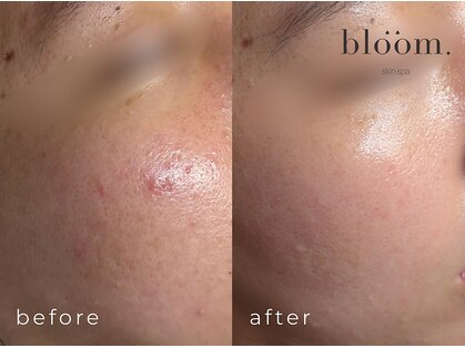 ブルーム(bloom.)の写真