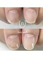 アーティネイルズ(Aaty Nails) 自爪育成剥離等のお悩みも！