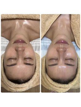 ジェニー(JENNI)/VVSダイヤモンドピーリング