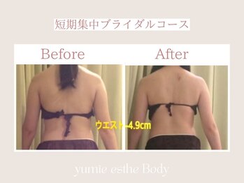 トータルビューティー ゆみえエステ(Total Beauty)/痩身 ブライダル