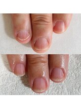 シーネイル(C Nail)/堂々と見せれる手元に!