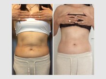 カロン 銀座(Kalon)/【腸もみ90分コース】10回結果！