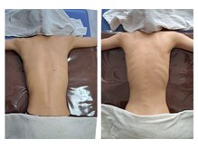 インディバサロン テスタ(testa)/before & after