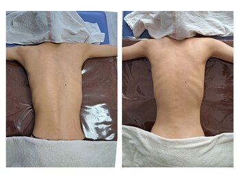 インディバサロン テスタ(testa)/before & after