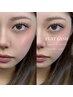【高持続LED】 FLATLASH 上140本＋下50本
