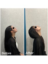 フロー鍼灸整体院(FLOW鍼灸整体院)/首の柔軟性 ビフォーアフター