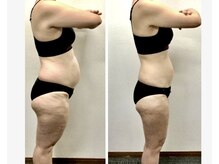 ラヴィアンローズ 忠節店(La vie en Rose)/体改善プラン before→after