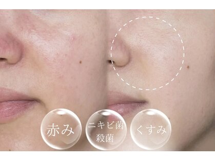 ルナベル(Luna Bell)の写真