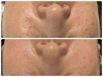 エフェクト 塚口店(effect)/Before After 50代/8回目