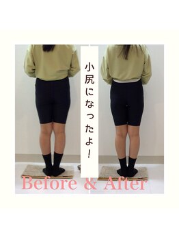 スタイルラボ高松/産後の骨盤矯正の効果♪