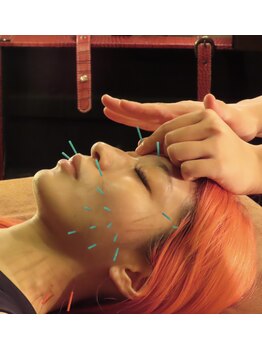 ピンクッション 平尾 薬院(PINKSHION)の写真/たるみ対策なら【深層ケア×浅層ケア】美容鍼×フェイシャルエステでたるみ＋ほうれい線に一気にアプローチ