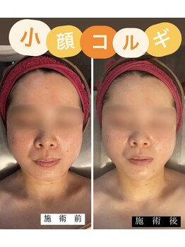小顔コルギサロン シー(She)/【コルギ】1度の変化!