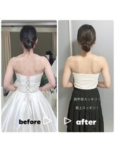 美容矯正専門サロン アカデミア(ACADEMIA)/花嫁様before after