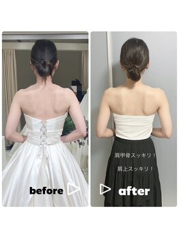美容矯正専門サロン アカデミア(ACADEMIA)/花嫁様before after