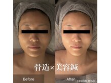 サロンリーナ 銀座店(SalonLena)/40代　1年経過ビフォーアフター