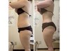【人気No.2】全身ハイパーナイフＥＸ＋痩身リンパ90分46200円→11000円