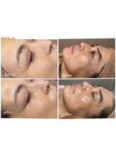 銀座ナチュラルスタイル/眼精疲労/骨盤矯正/