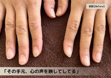 マニュキュア(Manicure)