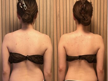 クララ(clara)/姿勢の歪みも変化します♪