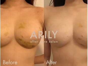 アリリィ(ARILY)/ARILY after care salon