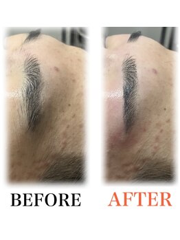 メンズブリリアンス/眉の形に迷った方でも◎