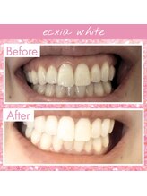 エクシアホワイト SOKA(ecxia white)/