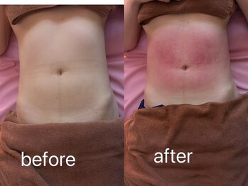 イーリバイブ/iNVYDOM MAX