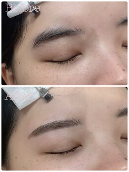 エッジアイ 梅田(edge eye)/レディース眉毛wax脱毛