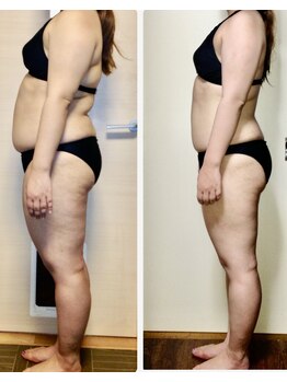 ルーミー(LUME.)の写真/《本気のダイエット》高性能マシンと強力ハンドの組み合わせでしっかり絞り出し理想のスタイルへ！