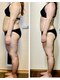 ルーミー(LUME.)の写真/《本気のダイエット》高性能マシンと強力ハンドの組み合わせでしっかり絞り出し理想のスタイルへ！