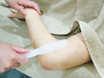 アローナ(Arona)/【全身脱毛】ジェル塗布