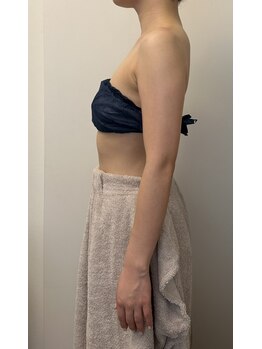 リバース(Rebirth)/脂肪燃焼剤導10ml導入アフター