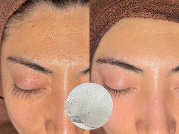 ルーナジェーナ(Luna llena)/池袋　エステ　ルーナジェーナ