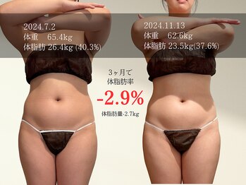 マルノウチ サロン(MARUNOUCHI salon)/20代のお客様/3ヶ月 担当:加藤