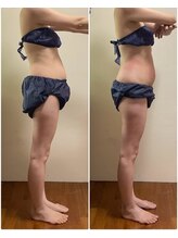 ニコワ(Nicowa)/Nicowaの痩身★BeforeAfter