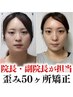 院長or副院長が担当◎¥22,000〈通常¥55,000〉歪み小顔矯正50ヶ所 60分