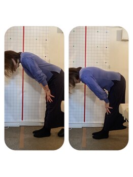 ハンズ治療院 東中野院/「姿勢矯正の症例」